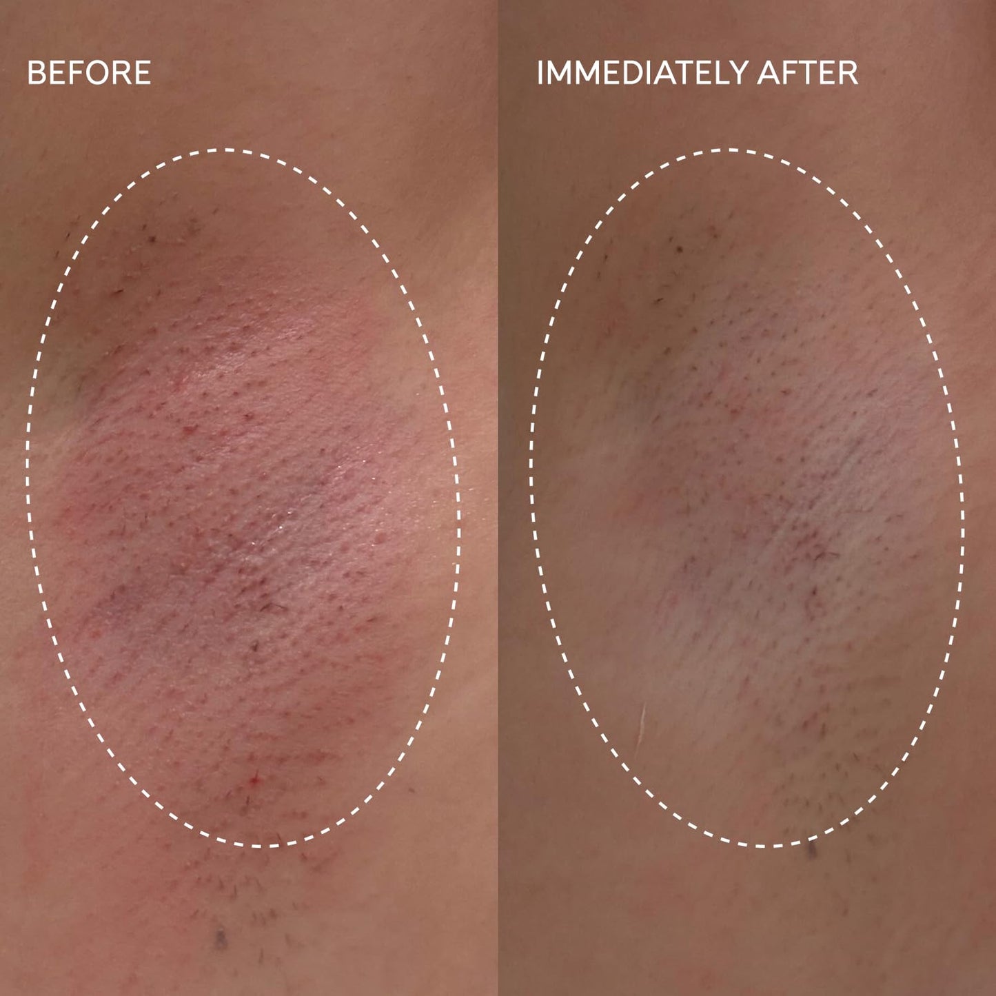 Fur Flash Repair Jelly – Hypochlorous Acid Aftercare Gel for Post-Wax, Shave, or Laser – Soothes Redness, Bumps, and Irritation Dermatologist-Tested, Fragrance-Free (2.0 fl oz / 60mL)