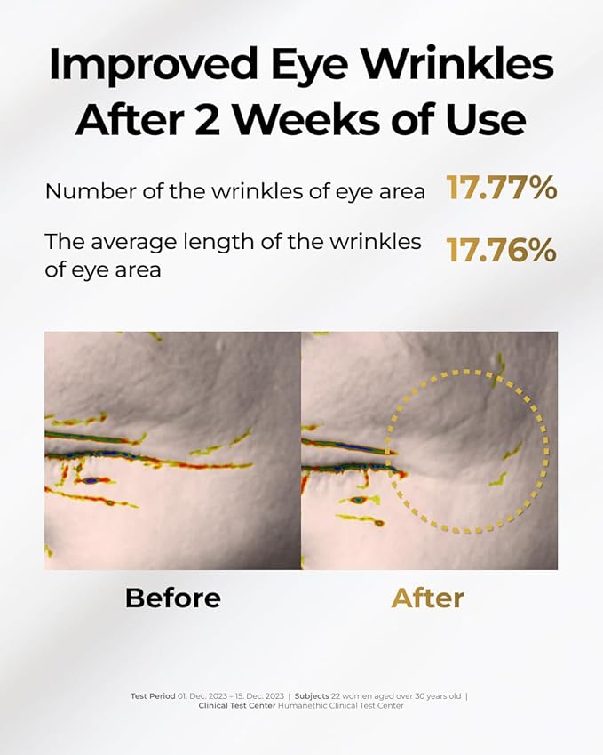 bom COSMETICS Peptide Power Eye Cream 1.05 Fl Oz, Penta-Peptide and 99% Pure Gold Lightweight Eye Cream for Skin Collagen Boost to Reduces Fine Lines, Wrinkles, Enhances Elasticity, Korean Skin Care