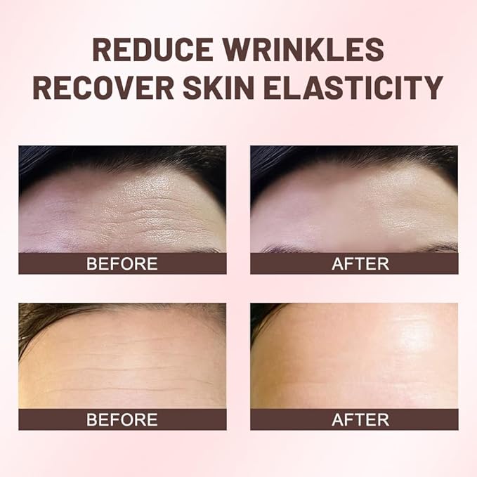 EVPCT 20pcs Forehead Wrinkle Patches - Face Tape for Smoothing Facial Wrinkles Overnight