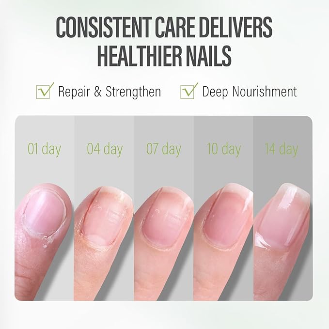 CHUCHU Nail Strengthener - Kiwi Scent Nail Repair Growth Moisturizing Treatment - Natural Jojoba Vitamin B & E Cuticle Oil for Dry Cracked Nails