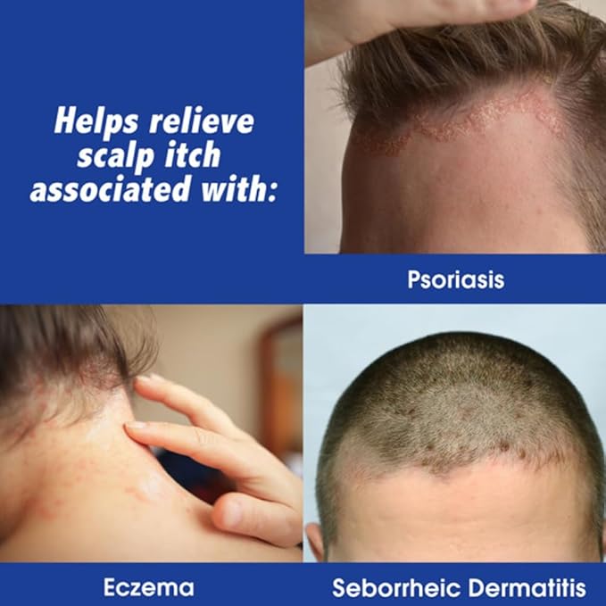 Scalpicin Max Strength Scalp Itch Treatment, 1.5 Ounce (Pack of 4)