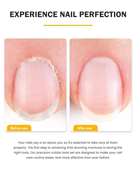 BEZOX Cuticle Trimmer with Pusher - Salon Quality Cuticle Clipper with Cuticle Pushers, Super Sharp Cuticle Cutters and Dual-End Nail Pushers Cuticle Stick, Professional Manicure Tools