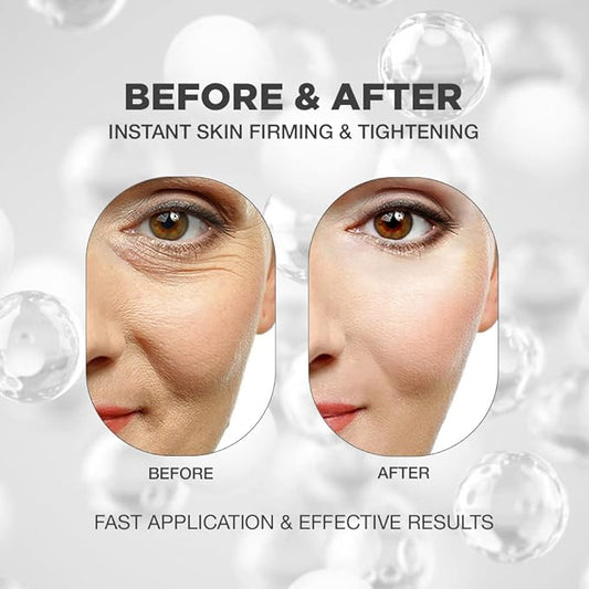 Instant Face Lift Serum | Skin Rejuvenating Face Tightening Serum for Face and Neck | Instant Face Lift Serum with Natural Ingredients | Age-Defying Skin Lifting, Face Tightening Serum for Face