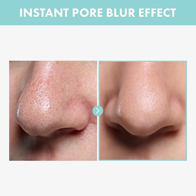 Pore Tightening Serum, Instantly Reduces Pores, Smooths Skin & Strengthens Barrier, Formulated With Niacinamide & Allantoin, Pore Minimizer For Face, Korean Skin Care, 30ml, 1.01 fl. oz.