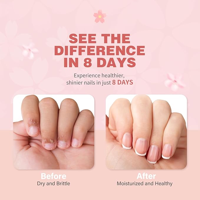 Cherry Blossom Nail & Cuticle Oil - Ultimate Hydration, Repair with Real Cherry Blossom Extract - Paraben-Free, Vegan & Cruelty-Free - 0.5 fl. oz