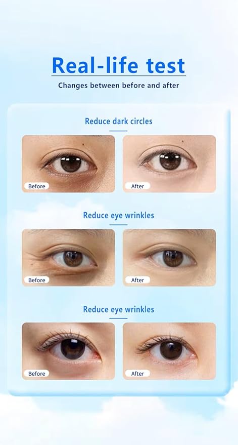 24K Gold Under Eye Treatment Mask, Dark Circle and Anti-Wrinkle, Hydrating eye mask, Puffiness & Eye Care, Collagen,Hyaluronic Acid & Castor Oil, 60 Pieces (Black 24K)