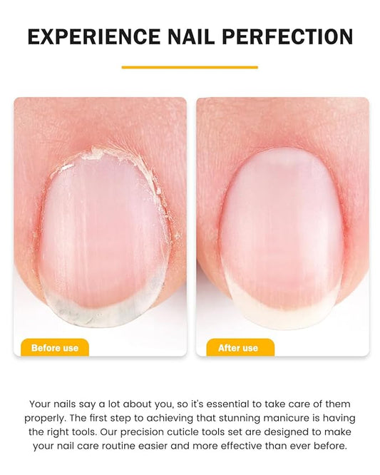 BEZOX Cuticle Trimmer with Pusher - Salon Quality Cuticle Clipper with Cuticle Pushers, Super Sharp Cuticle Cutters and Dual-End Nail Pushers Cuticle Stick, Professional Manicure Tools - Rainbow