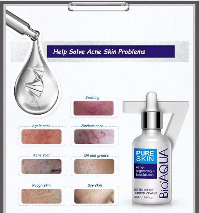 BIOAQUA 3in1 Face Acne Scar Removal Spots Oil Cream Scar Blemish Marks Moisturizing Oil 100g+30g+30ml