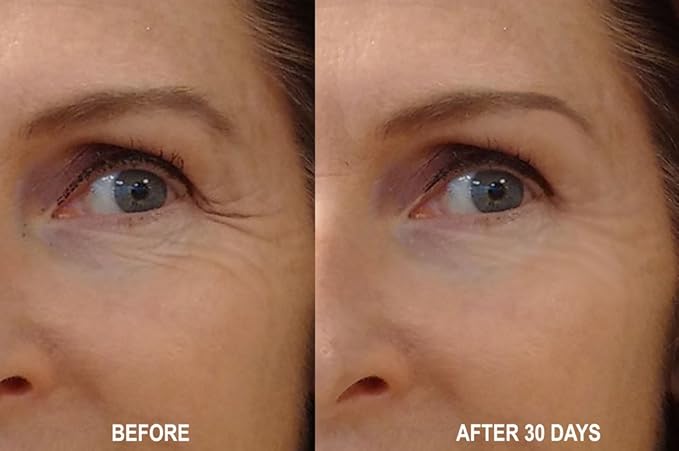 DNA Code®-No Needle Alternative-Pure Argireline Peptides Wrinkle Reduce Serum+ Matrixyl 3000+Hyaluronic Acid