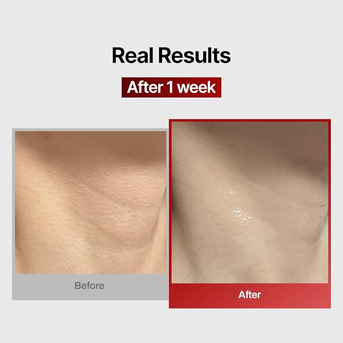 Wrinkle-fit Neck Mask - Neck Wrinkle Patches, Firming and Tightening Korean Deep Collagen Mask - Hyaluronic Acid NeckTargeted Mesh Sheet Mask for Lifting Sagging Skin - Boosting Elasticity 7EA