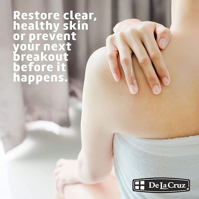 De La Cruz 10% Sulfur Ointment - Cystic Acne Treatment for Face and Body - Daily 10 Min Spot Treatment Mask Safe and Effective Game Changing Hormonal Acne Treatment that Clears Up Pimples 2.6oz 2 Pack