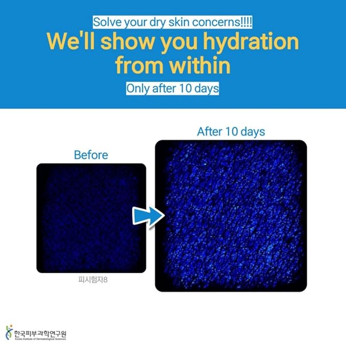 Organic Shea Butter Moisturizing Lip balm, Multi-purpose, Nourishing, Hydrating, Chemical-free, Non-toxic, Shea butter Scent (10, Grams), Dry Skin, Dryness, Korean