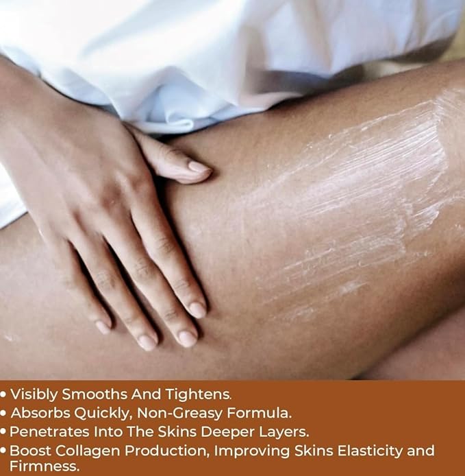 Bunda Body Butter Whipped Shea & Cocoa Butter Infused With Moringa Oleifera & Sodium Hyaluronate-Intense Hydration for Dry Crepey Skin 10.6oz