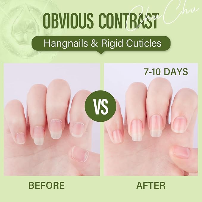 CHUCHU Cuticle Oil for Nails: Jojoba Nail Cuticle Oil for Repair and Strengthening Nails - Vitamin B & E Moisturizes Cuticle and Nail's Skin - Prevents Hangnails and Chapped 15ML Aloe