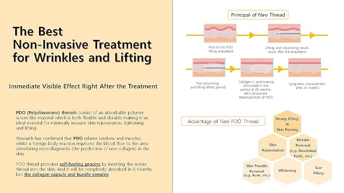 NeoGenesis PDO Mono Threads for Face and Body Lift 20PCS (31G X 12mm) (M3112)