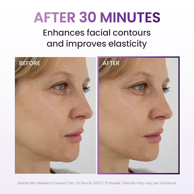 Probioderm™ 3D Lifting Full Face Tension Gel Mask | NOT a Hydrating Mask – Firming & Tightening for Lifted, Sculpted Skin | 20-Peptide Complex & PDRN for Face Contouring & Jawline Definition