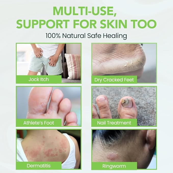 THENA Athletes Foot Treatment Balm Extra Strength, Tea Tree Foot Cream, Heals Dry Cracked Feet Heels Itchy Skin Nails Toenails Advanced Foot Care for Men Women