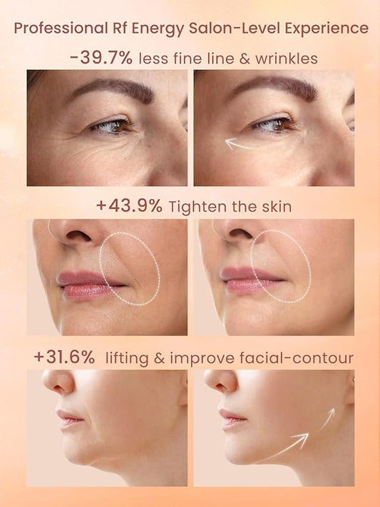 Radio Frequency Skin Tightening Device, Professional Wireless Home RF Skin Tightening Face Machine, Effective Face Wrinkle Removal, Lifting, Firming