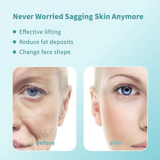 Pdo Threads Pdo Threads Lift for Face Smoothing Wrinkles Pdo Screw Threads Producs Collagen Pdo Lifting Threads Skin Tighten 27g50mm 40Pcs