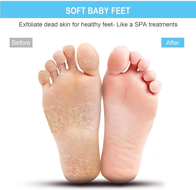 BESKAR Larger Shower Foot Scrubber Mat with Non-Slip Suction Cups- Cleans, Smooths, Exfoliates & Massages your Feet Without Bending, Improve Foot Circulation & Soothes Tired Feet- Black