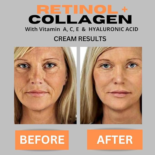 Retinol + Collagen, Hyaluronic Acid, Vitamin C Anti-Aging Face Cream, Day and Night Moisturizing Cream, Anti-Wrinkle Cream for Face, Firming Cream - 4oz