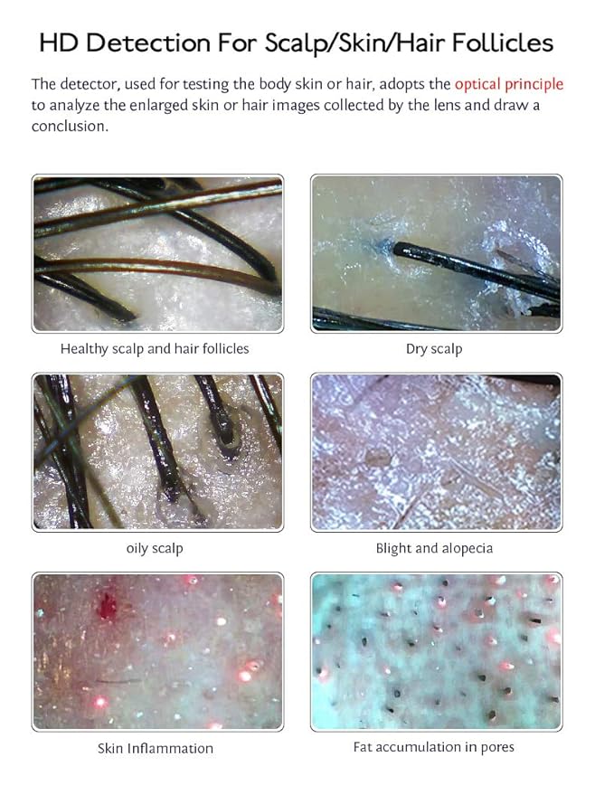 Skin Hair Scalp Detector Hair Follicle Facial Skin Oil Moisture 11 Inch HD LCD Screen Microscope Tester