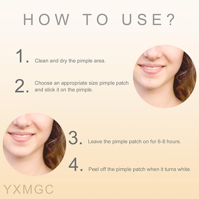 Pimple Patches for Face – Hydrocolloid Acne Patches with Tea Tree Oil, Covers Zits, Pimples, and Blemishes on Face and Skin, Multi-Size Zit Patches (240 Patches)