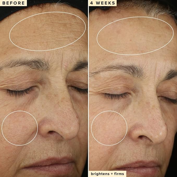 Farmacy 10% Vitamin C Face Serum - Waterless Vitamin C Skin Care Serum to Brighten, Firm + Smooth Skin Texture - Enriched with Upcycled Tangerine Peel to Boost Skin's Moisture + Radiance (5ml)