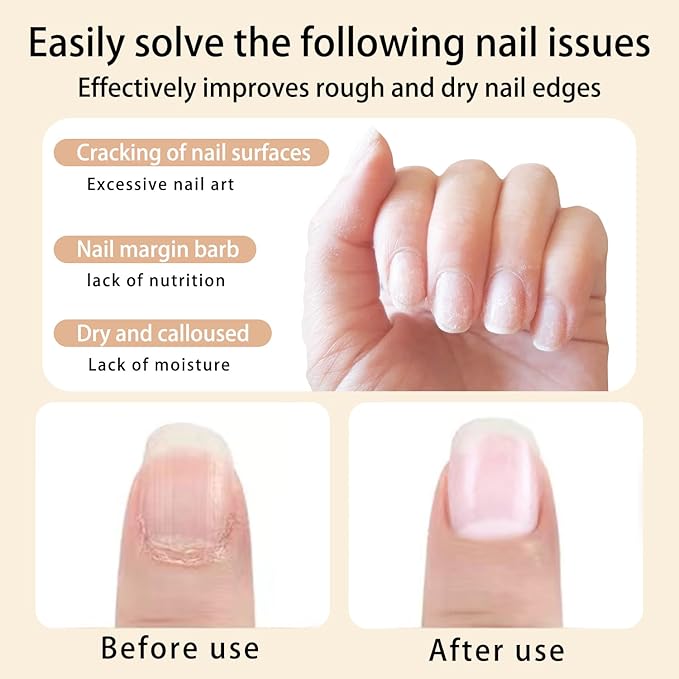 Cuticle Oil Pen for Nails Care,Nail Oil For Strength,Nourish Moisten Care Nail Cuticle Oil To Reduce Nail Cracking and Dry for Weak Peeling Brittle and Thin Nails （Osmanthus&orange）