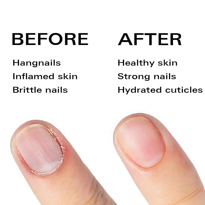 Nail Oil Cuticle Pen - Fragrance Free - Nail Strengthener & Growth Serum with Vitamin A, D, E, B5, Grapeseed & Natural Oils - Repair for Brittle, Peeling, Thin Nails (No Scent)