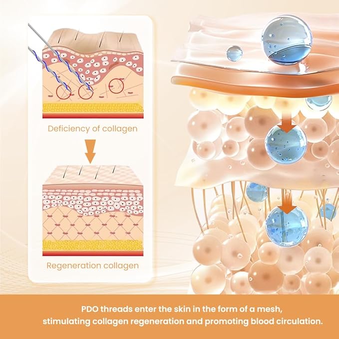 PDO Thread(Mono 26G 60MM) Lift/Face Body Lifting/Smooth Mono Type 26G 60mm(50pieces)