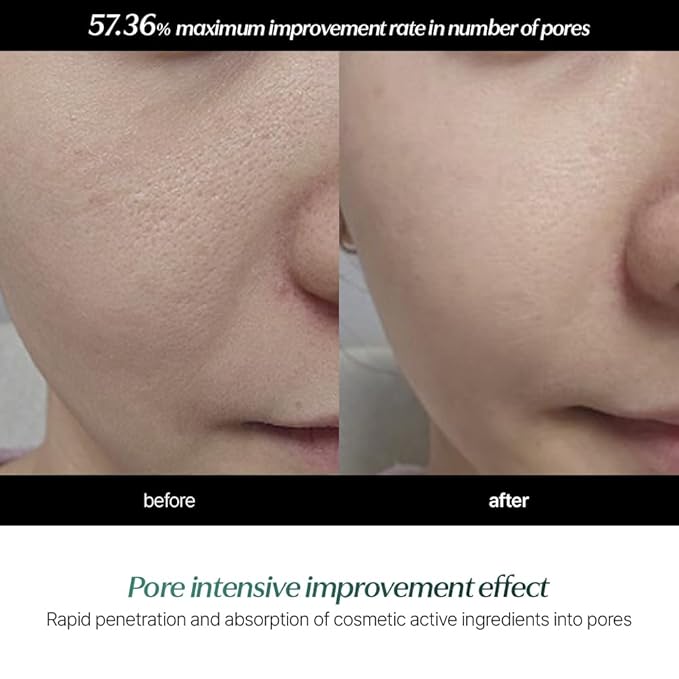 Potension Pore Tightening Boost Serum - Advanced Korean Skincare Pore Minimizer with Exosome Technology, Targets Excess Sebum & Impurities (1.01 fl.oz)