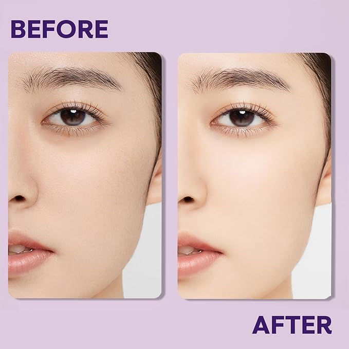 Eye Cream for Bag Under the Eyes, Dark Circles, Swelling Treatment, Anti-aging, Minimizes Wrinkles, Moisturizing Eyes Cream for Women, Suitable for Sensitive Skin 0.5Fl (15ml), 1 Count