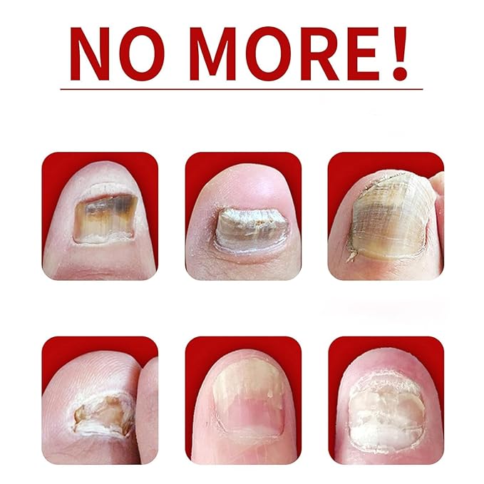 Ginger Nail Growth Serum, 7 Days Nail Treatment, Ginger Nail Treatment, Ginger Cuticle Care Oil for Strengthen & Promote Nail Growth (2Pcs)