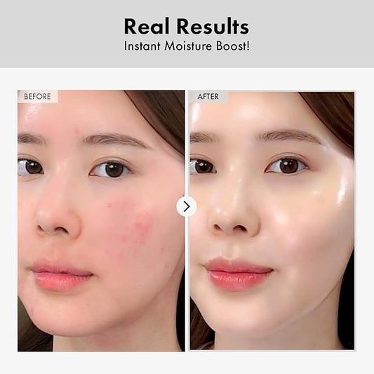 Hyaluronic Acid Ampoule, Hydrating Glow and Skin Barrier Protection, Anti-Aging Face Serum for Dry Skin, Korean Skincare Beauty Products, 100ml, 3.38 fl. oz.