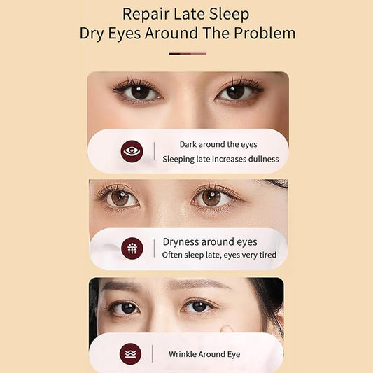 BLUE LOVE Anti-Aging Eye Cream – Reduces Dark Circles & Puffiness, Moisturizing Under-Eye Bags & Fast-Absorbing Wrinkle Treatment for Men & Women, 0.7oz