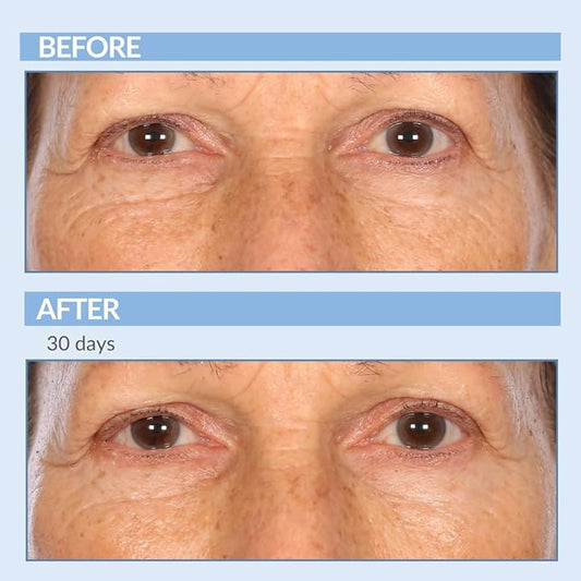 Serious Skincare - Retinol Vitamin A Eye XR Under Eye Cream Concentrate - Reduce Fine Lines, Dark Circles & Puffiness - Daily Wrinkle Cream - Anti-Aging - 0.5 oz