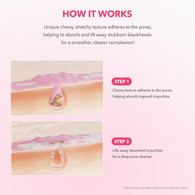 APRILSKIN TXA Niacinamide 99 Pore Care Pink Bubble Gum Deep Cleanser | 99% High-Purity TXA+Niacinamide | All-in-One Cleanser: Deep Cleansing, Blackhead Care, Pore Care, Moisturizing | 4.23 fl.oz.