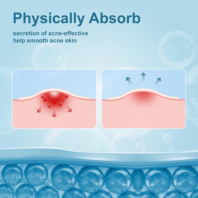 Pimple Patches for Face, Hydrocolloid Acne Patches, Absorb Zits and Blemishes, Invisible Spot Cover, Treatment for Breakouts, Acne Stickers with Salicylic Acid and Tea Tree Oil (24 Count)