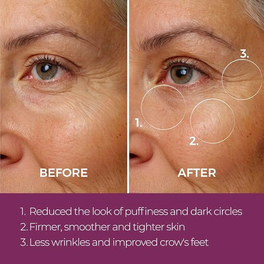 Blinc Eye Repair Peptide Complex | Clean, Vegan, Eye Cream | Anti-Aging, Anti-Wrinkle, Ultra Hydrating | Reduces Fine Lines, Dark Circles & Puffiness | Brightens, Firms & Evens Skin | 15 g / 0.53 oz