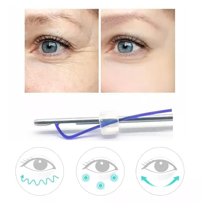 Oldream Pdo Threads Eye Lift for Eyes, Mono Screw Type, B-Type, 30G25MM, 20pcs