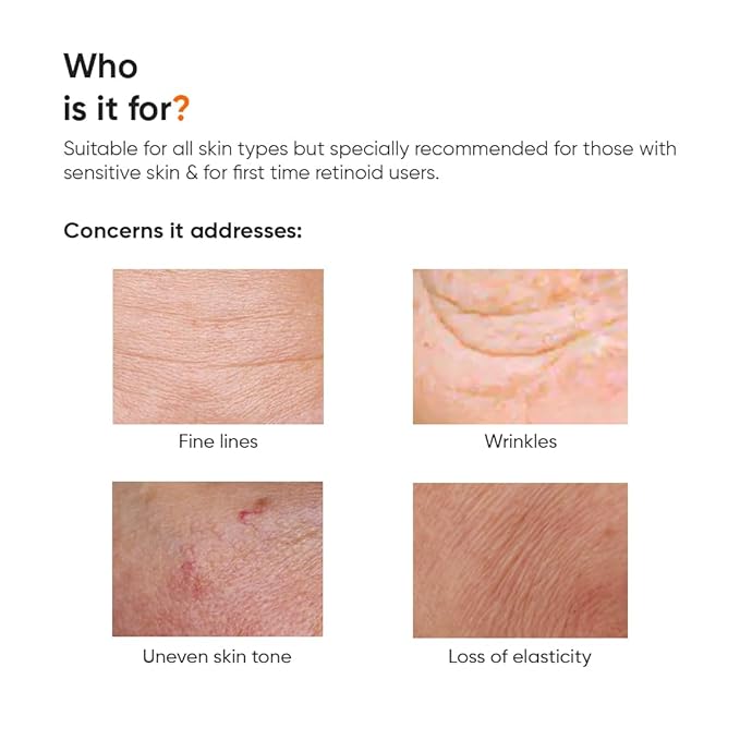 Minimalist 2% Retinoid Anti Aging Night Cream for Wrinkles & Fine Lines | Improves Skin Elasticity, Stimulates Collagen Production for Radiant & Glowing Skin | 1 Fl Oz / 30 ml