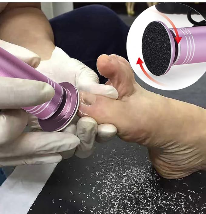 Upgraded Electric Foot Callus Remover 0-1200rpm, Professional Electric Foot File Sander Pedicure Tools for Dead Skin Cracked Heels, Adjustable Speed, 60 Replaceable Sandpaper Discs (FCR-2 Pink)