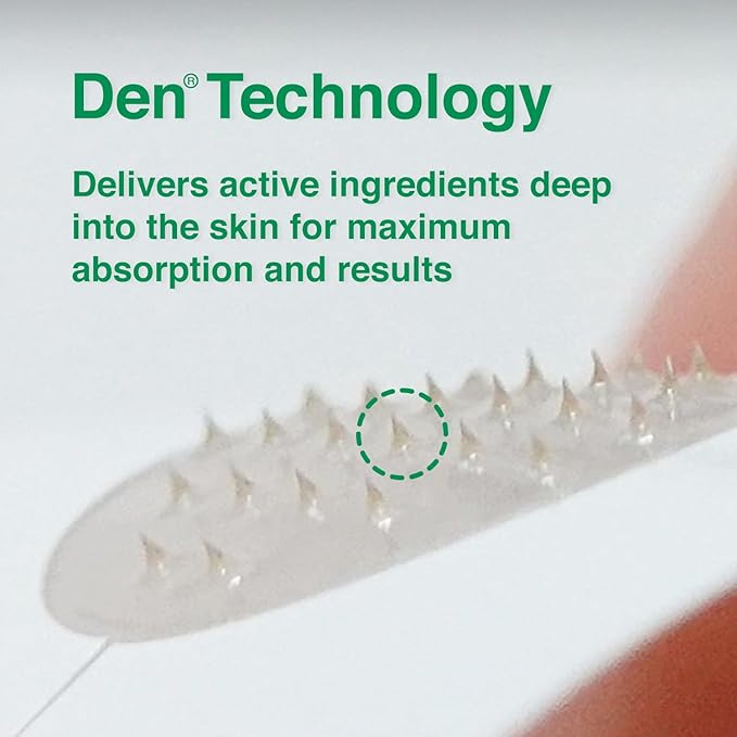 ACROPASS Acne Cure DEN Microarray Patch, OTC Salicylic Acid 2% (4ct) – Acne Treatment for Sensitive Skin, Anti-Inflammation