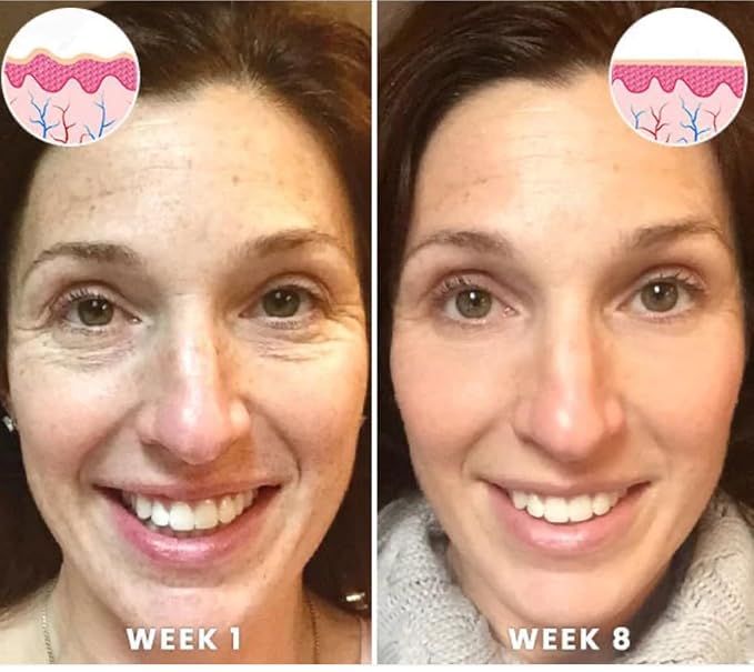 Squalane and Vitamin C Rose Serum. Anti Aging Anti Wrinkle Brighten, Hydrate, Firm and Reveal Radiant Skin 1.0 ounces