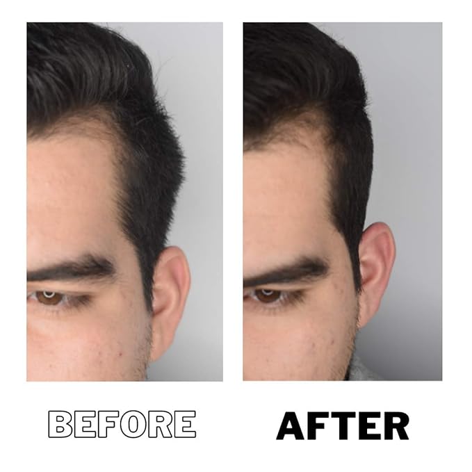 Down Perm | DPERM Serum Concentrate Kit