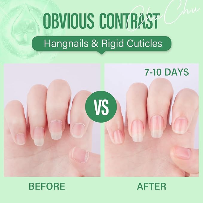CHUCHU Organic Cuticle Oil for Nails: Kiwi Jojoba Nail Oil with Vitamin B & E - Moisturizes Repairs and Promotes Nail Growth - Prevents Dryness Hangnails and Chapped Skin 15ML