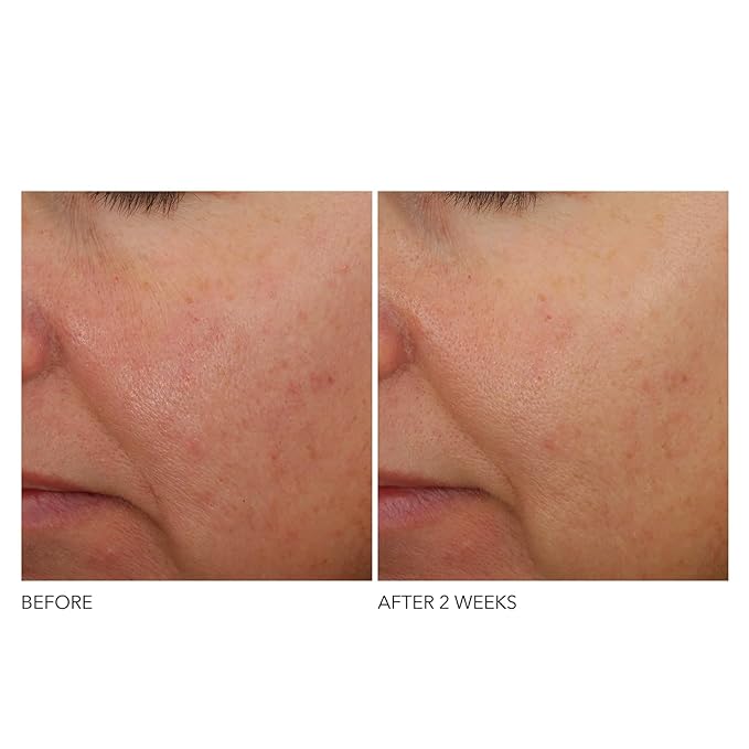 Dr Dennis Gross Advanced Retinol + Ferulic Overnight Wrinkle Treatment: Visibly Firm, Restore Hydration & Reduce the Look of Wrinkles, 1 oz