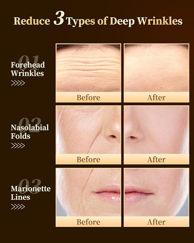 Moisturizer Face Cream Anti Aging, 30% C-Xyloside Solution Night Cream For Face Tightening Firming, Supramolecular Infiltration Technology