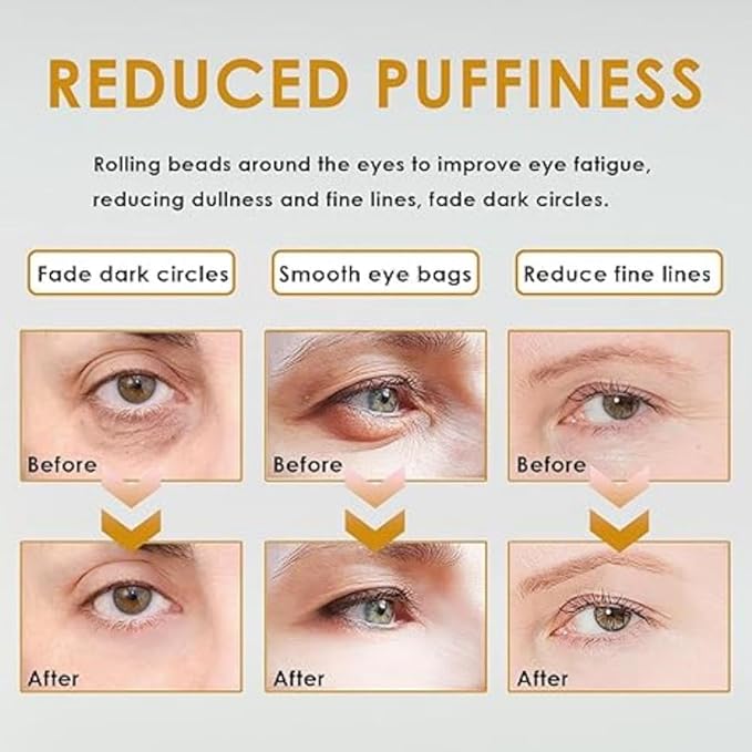 SWANNA 2 PCS Roller Ball Castor Oil,Castor Oil Frankincense Rollerball, Rollerball Castor Oil for Eyes, Bags Under Eyes,Fluffy and Reduce Swelling